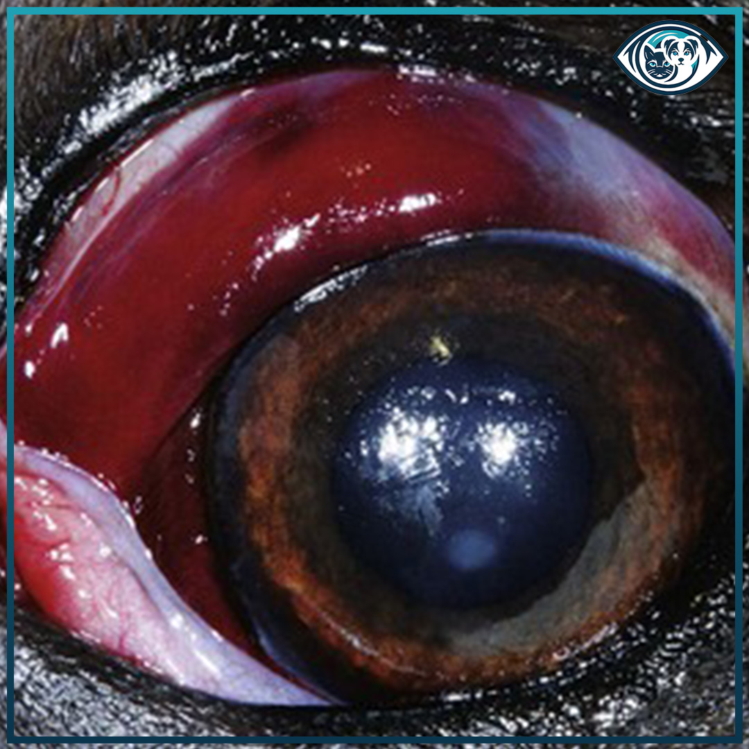 Subkonjunktival Hematom Nedir?