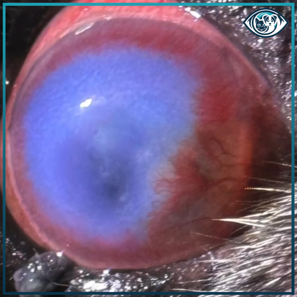 Pedikül Konjonktival Flep Cerrahisi ile Derin Kornea Ülseri Tedavisi